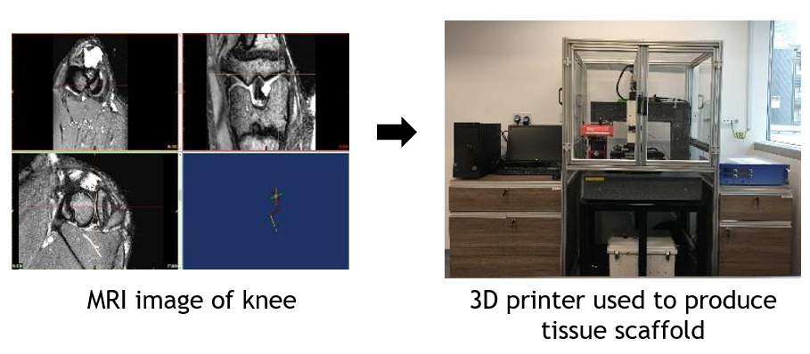 MRI image